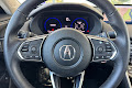 2025 Acura TLX Technology Package